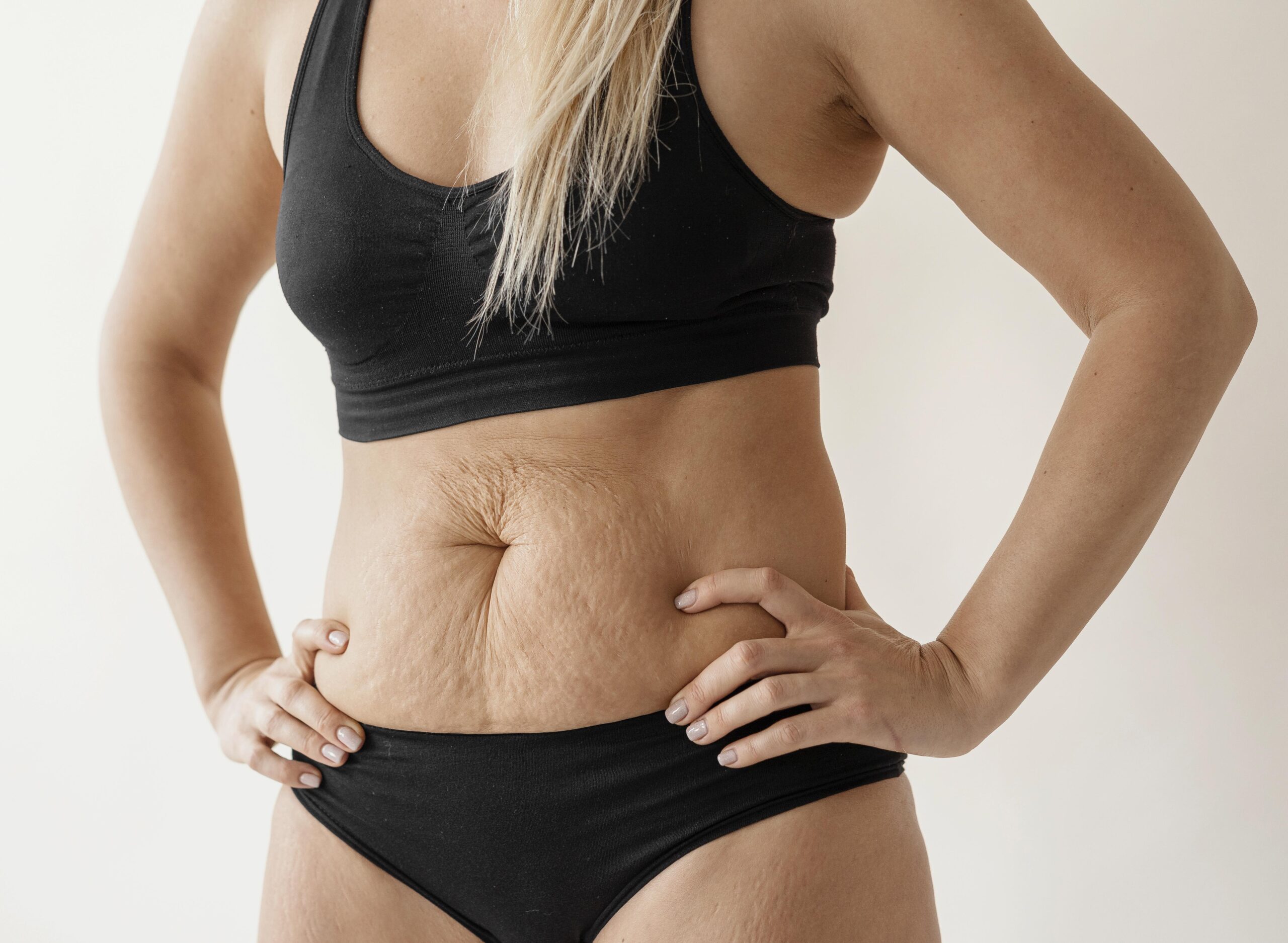 woman in black underwear showing her tummy